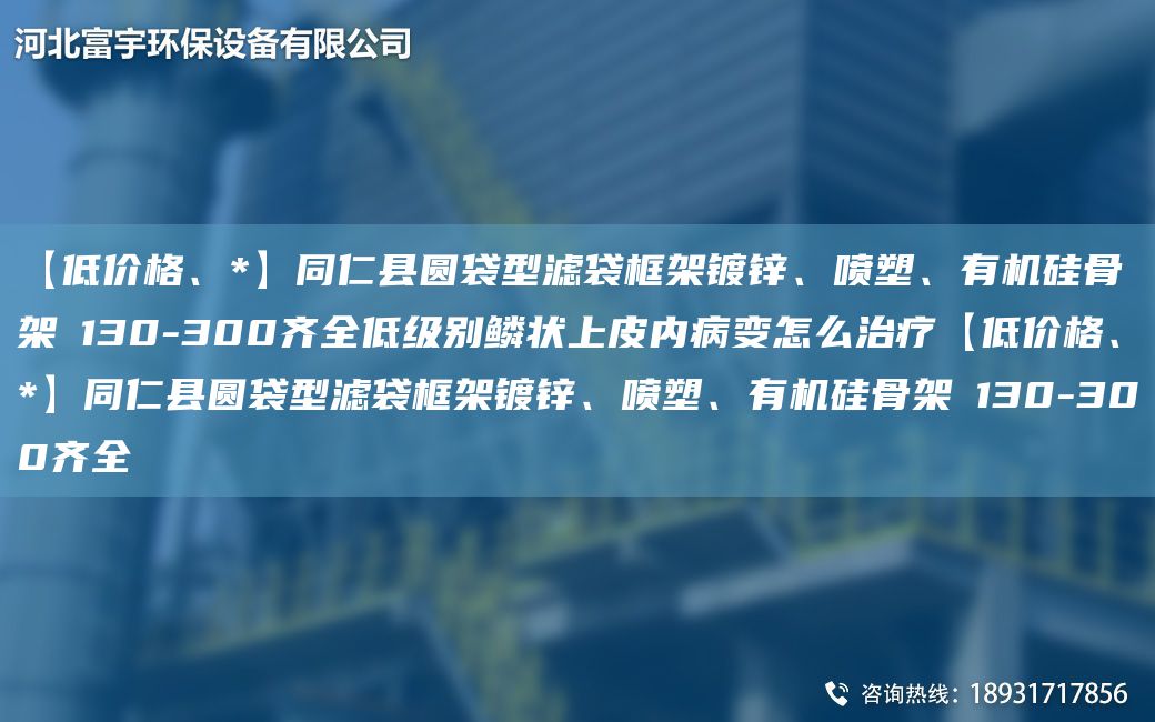 【低价格、*】同仁县圆袋型滤袋框架镀锌、喷塑、有机硅骨架Φ130-300齐全低级别鳞状上皮内病变怎么治疗【低价格、*】同仁县圆袋型滤袋框架镀锌、喷塑、有机硅骨架Φ130-300齐全